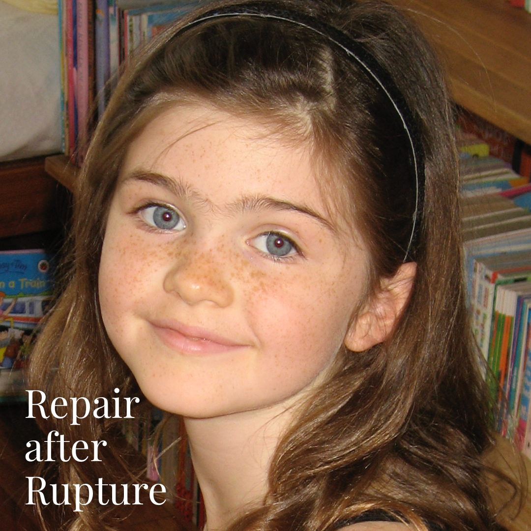 Lana Repair after rupture free PDF flodesk email header 1080 x 1080